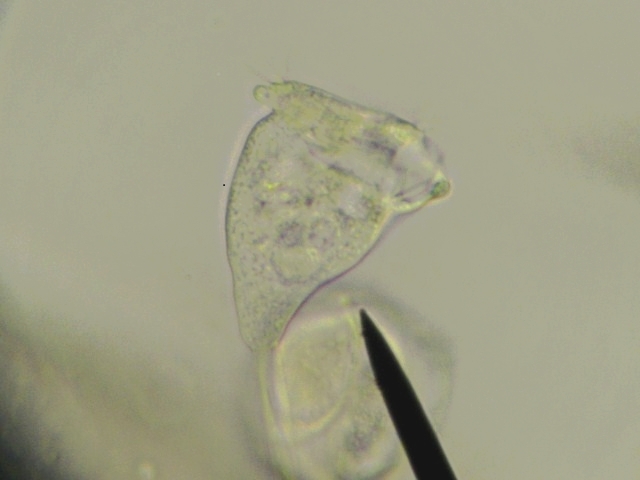 vorticella